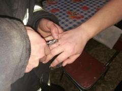 Хойникские спасатели сняли кольцо с пальца жительницы города